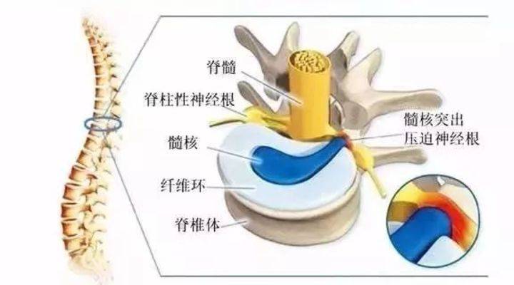 11月2日根線蟲(chóng)最新根治法詳解，有效治療根線蟲(chóng)的方法與解析