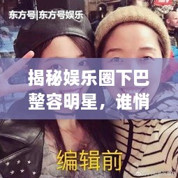 揭秘娛樂圈下巴整容明星，誰悄悄整過下巴？