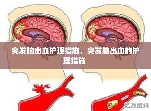 突發(fā)腦出血護理措施，突發(fā)腦出血的護理措施 