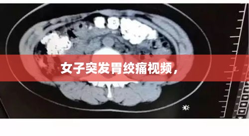 女子突發(fā)胃絞痛視頻， 