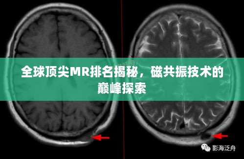 全球頂尖MR排名揭秘，磁共振技術(shù)的巔峰探索