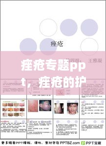 痤瘡專題ppt，痤瘡的護(hù)理ppt 